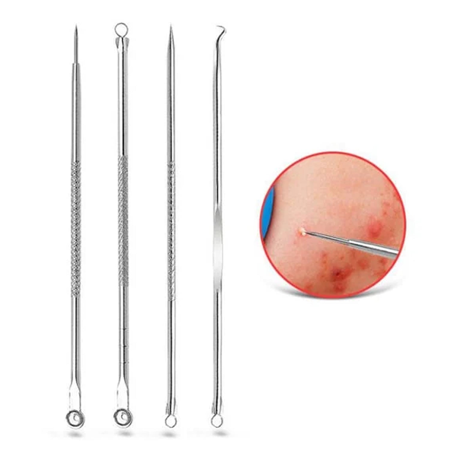 Blackhead Remover, 4-in-1 Stainless Steel Pimple Extractor Tool (1 Pc) Blackhead Remover, 4-in-1 Stainless Steel Pimple Extractor Tool (1 Pc)